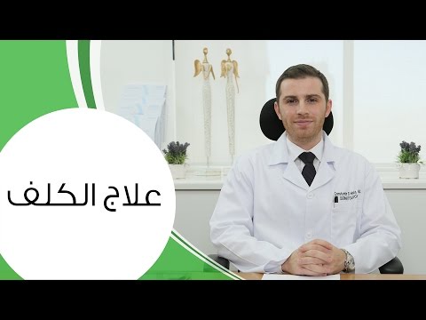 الحلول المثلى للتخلص من الكلف