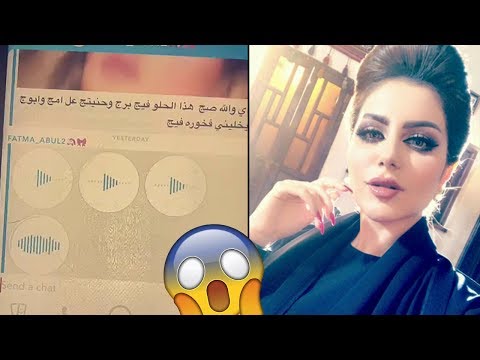 الفنانة حليمة بولند تشعر بالصدمة