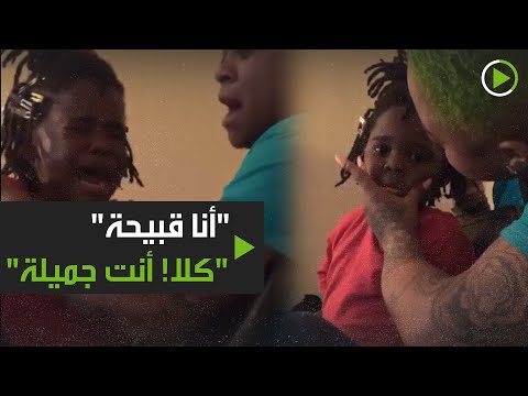 شاهد طفلة تردد أنا قبيحة والأم تؤكد كلا أنت جميلة