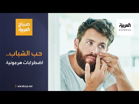 شاهد الاضطرابات الهرمونية تلعب دورًا كبيرا في ظهور حب الشباب