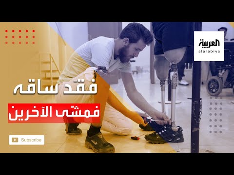 شاهد فقد ساقه في الحرب فتحوّل لمصمم أطراف صناعية