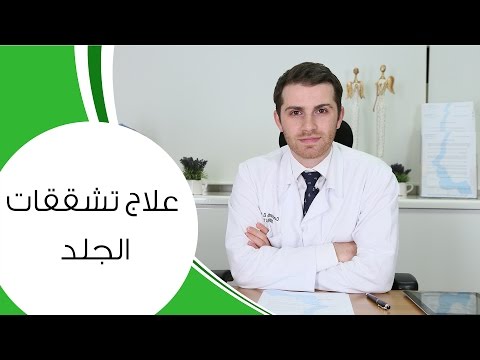 شاهد أفضل طرق التخلص من تشققات الجلد